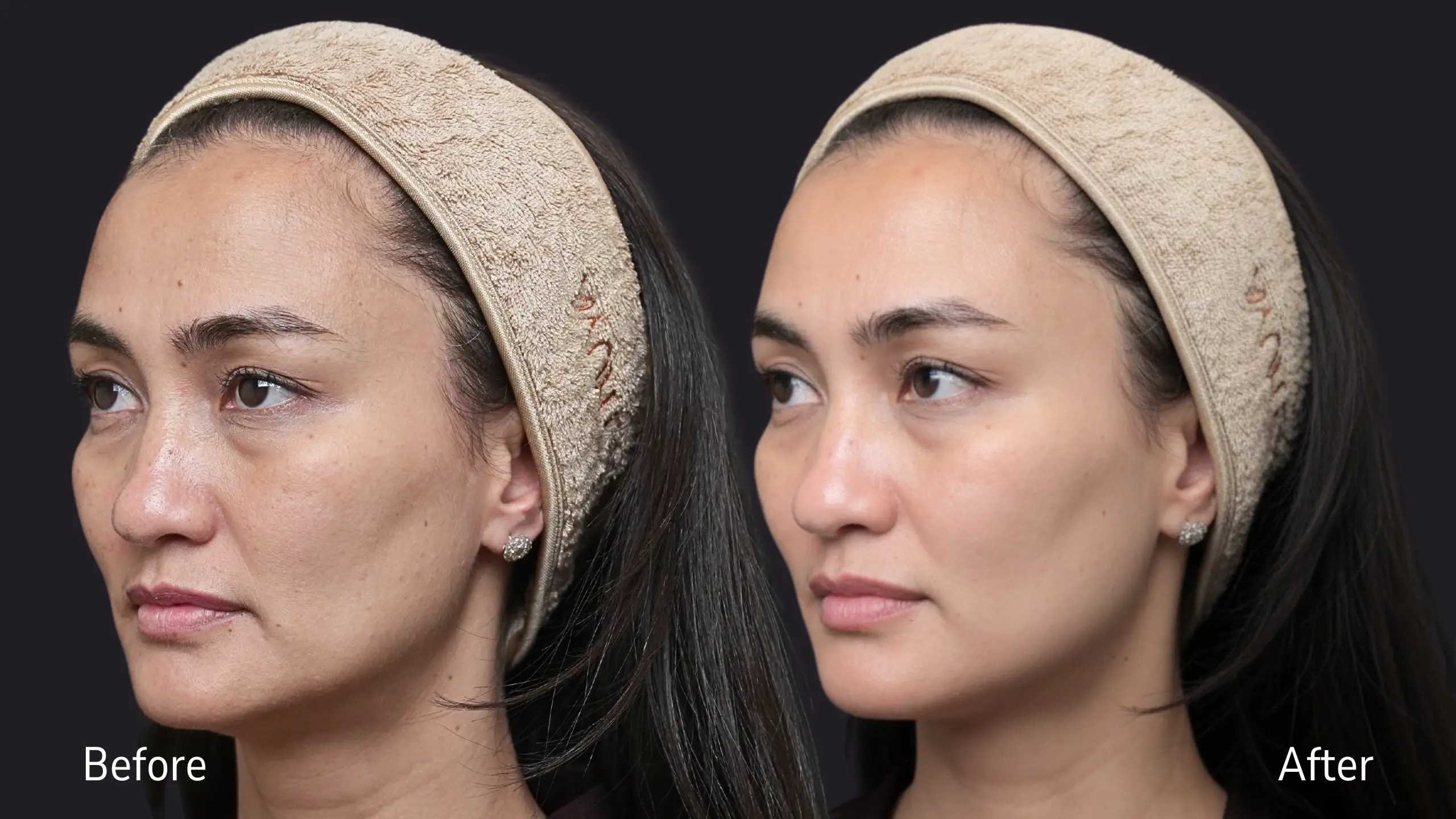 Before and after treatment