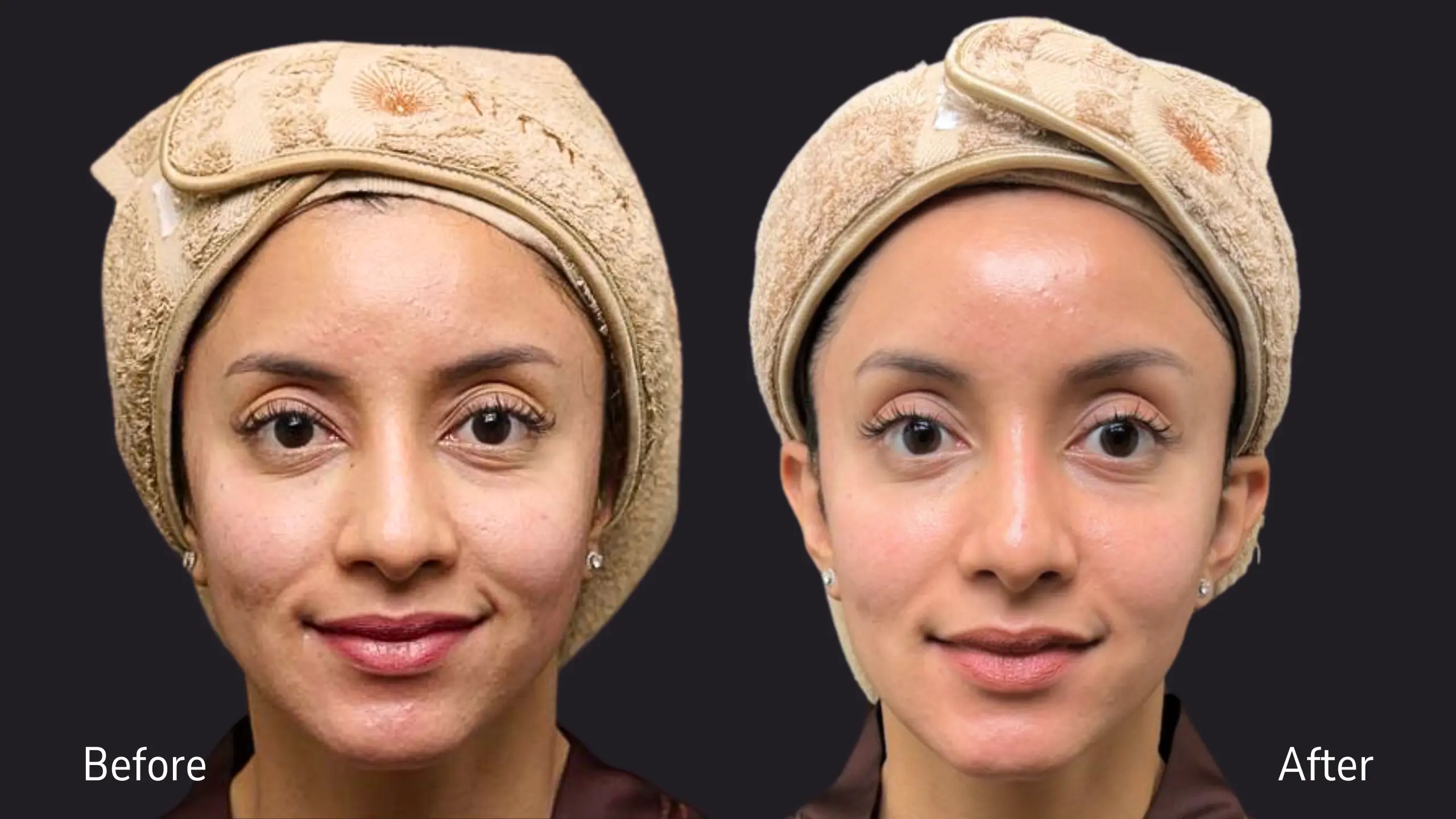 Before and after treatment